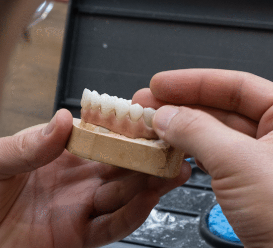 Corone Dentali