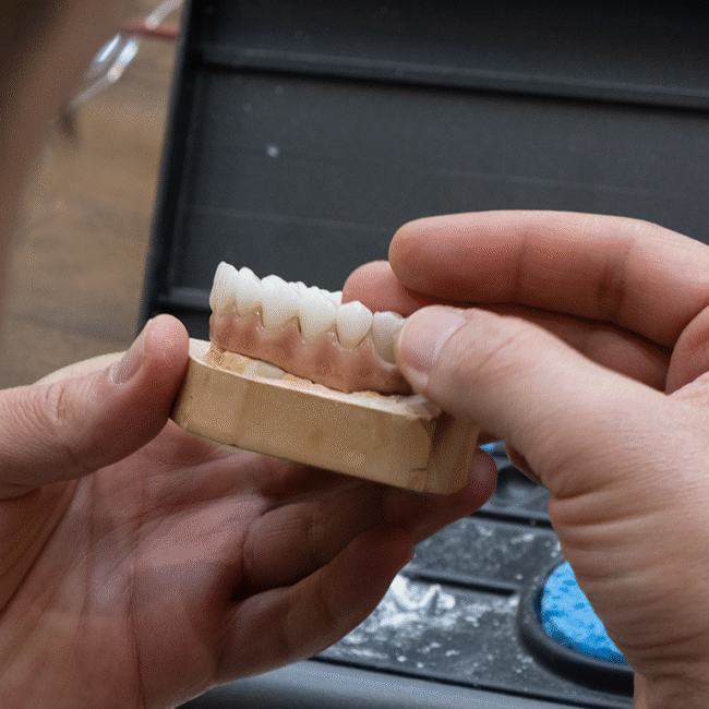 Corone Dentali